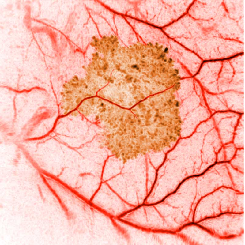 Photoacoustic image of the blood vessel network surrounding a tumour.