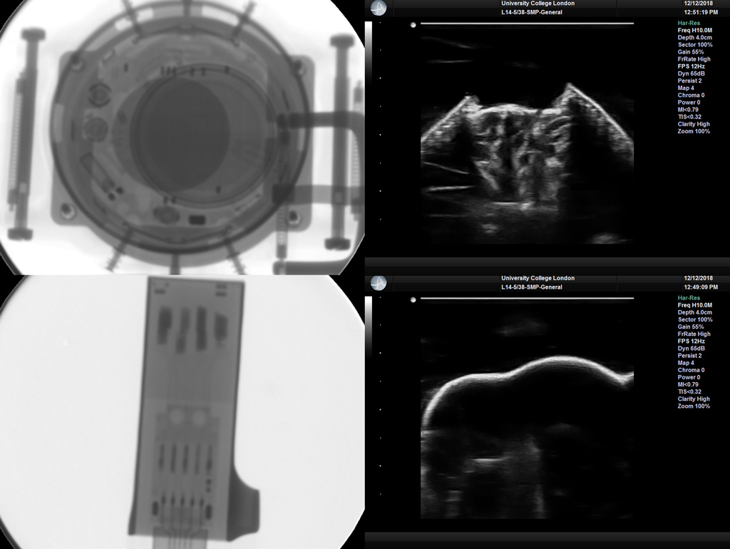 UCAS X-ray and ultrasound images
