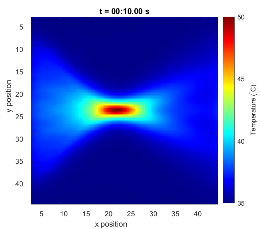 Image of temperature map generated using a high-intensity focused ultrasound transducer.